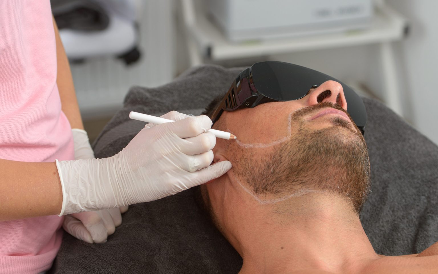 men's laser hair removal